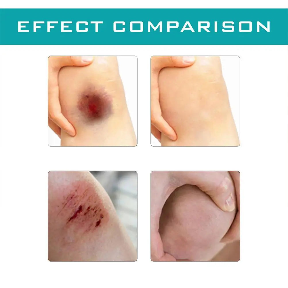 Liquid Bandage Spray Promote Wound Healing Bleeding Bruising Skin Recovery Wound Cleansing Breathable Waterproof Band Aid Spray