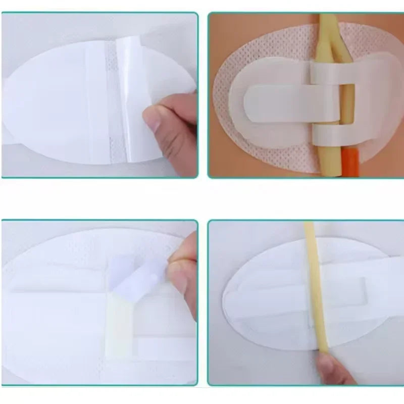 Medical peripheral central venous catheter fixation for tube fix