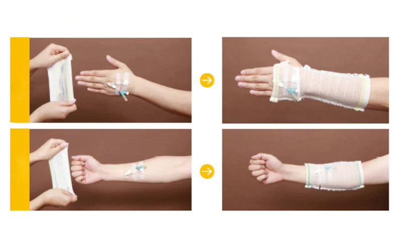 1Pc Breathable Medical Elastic Bandage PICC Mesh Nursing Protective Sleeve Cannulate Venous Indwelling Needle Fixation Sheath