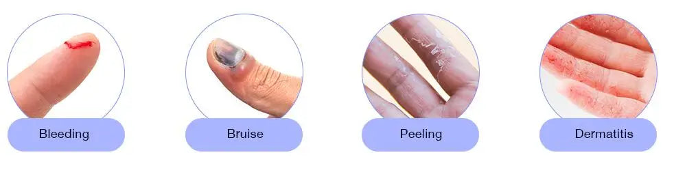 10Pcs Tubular Bandage Finger Roll Bandage Dressings Finger Bandage Tubular Finger Dressing Finger Cots Bandag for Finger Sprains